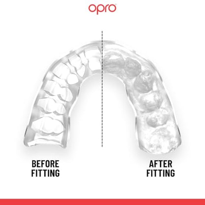 OPRO Official UFC Fighter Collection Alex Pereira Instant Custom-Fit Mouthguard – Self-Fit Gum Shield for MMA, Boxing & Combat Sports - color: Alex Pereira