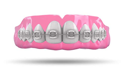 Impact Mouthguard Boxing, MMA, Muay Thai Sports Mouthguards for Youth Adults, Professional Custom-Fit, Braces - color: Braces