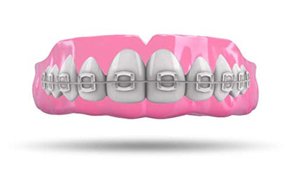 Impact Mouthguard Boxing, MMA, Muay Thai Sports Mouthguards for Youth Adults, Professional Custom-Fit, Braces - color: Braces