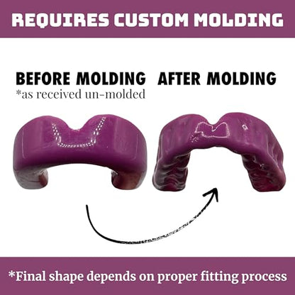 Zero-G Sports Mouthguard Purple 1-Pack - Adult Size - Boil & Bite - Basketball, Football, Soccer, Baseball, Hockey, Lacrosse - color: Purple