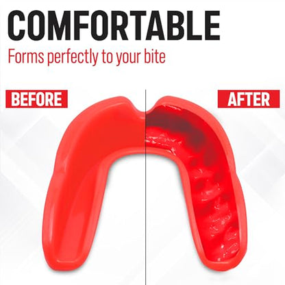 Basic Sports Mouthguard for Boxing, MMA & Football | Boil-and-bite fit with ventilated case - color: Pink
