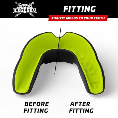 Legenda Sports Mouthguard for Kids (w/Case), Professional Mouthguard for Boxing, MMA, Karate, Football, BJJ, Martial Arts, Rugby, Lacrosse, Hockey (Black-Green) - color: Black-green