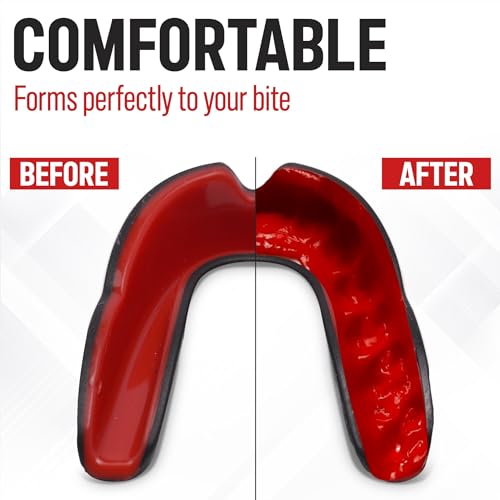 Basic Sports Mouthguard for Boxing, MMA & Football | Boil-and-bite fit with ventilated case - color: Black