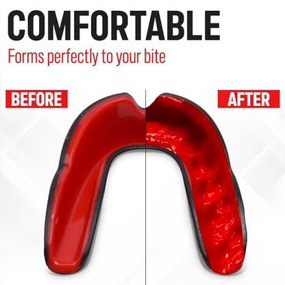 Basic Sports Mouthguard for Boxing, MMA & Football | Boil-and-bite fit with ventilated case - color: Black