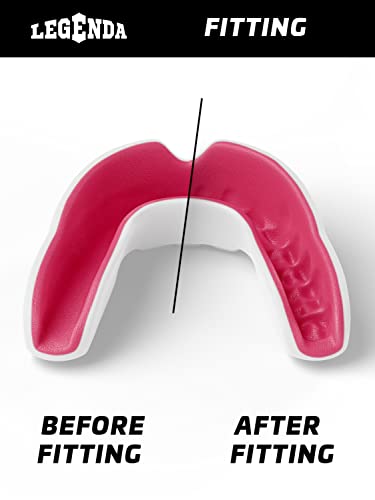 Legenda Sports Mouthguard for Kids (w/Case), Professional Mouthguard for Boxing, MMA, Karate, Football, BJJ, Martial Arts, Rugby, Lacrosse, Hockey (White/Pink) - color: White-pink
