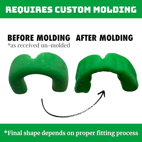 Zero-G Sports Mouthguard Green 1-Pack - Adult Size - Boil & Bite - Basketball, Football, Soccer, Baseball, Hockey, Lacrosse - color: Green