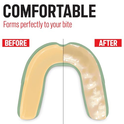 Basic Sports Mouthguard for Boxing, MMA & Football | Boil-and-bite fit with ventilated case - color: Basil