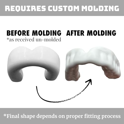Zero-G Sports Mouthguard White 1-Pack - Adult Size - Boil & Bite - Basketball, Football, Soccer, Baseball, Hockey, Lacrosse - color: White