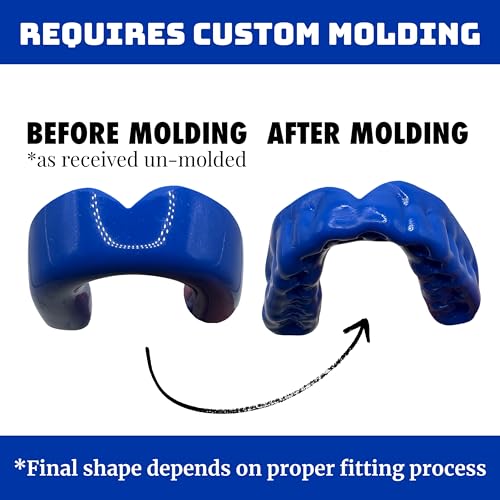Zero-G Sports Mouthguard Blue 1-Pack - Adult Size - Boil & Bite - Basketball, Football, Soccer, Baseball, Hockey, Lacrosse - color: Blue