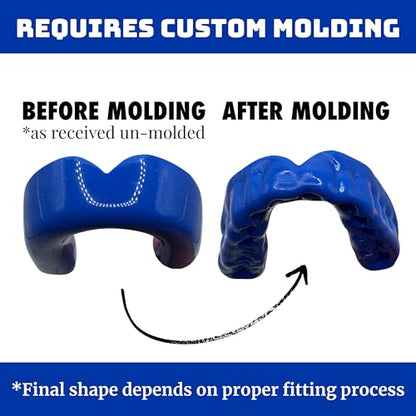 Zero-G Sports Mouthguard Blue 1-Pack - Adult Size - Boil & Bite - Basketball, Football, Soccer, Baseball, Hockey, Lacrosse - color: Blue