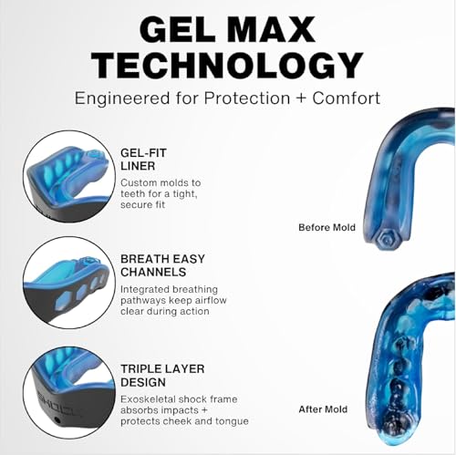Shock Doctor Gel Max Power 카본 컨버터블 마우스 가드 - color: 블랙 디바인 드립, size: 성인