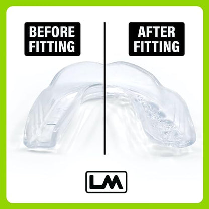 Loudmouth Sport Slim-Fit Boil & Bite Mouth Guard (2 Pack) Plus Mouthguard Case, Advanced Protection for All Contact Sports (Clear) - color: Clear