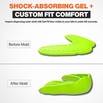Shock Doctor MicroGel Sports Mouth Guard, Football, Basketball, Boxing, Lacrosse Mouthguard - color: Black/Shock Green