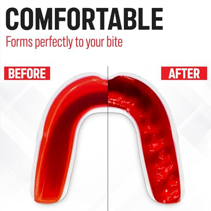 Basic Sports Mouthguard for Boxing, MMA & Football | Boil-and-bite fit with ventilated case - color: Bone White