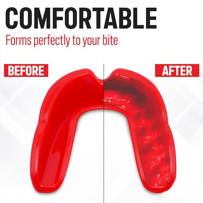 Basic Sports Mouthguard for Boxing, MMA & Football | Boil-and-bite fit with ventilated case - color: Red