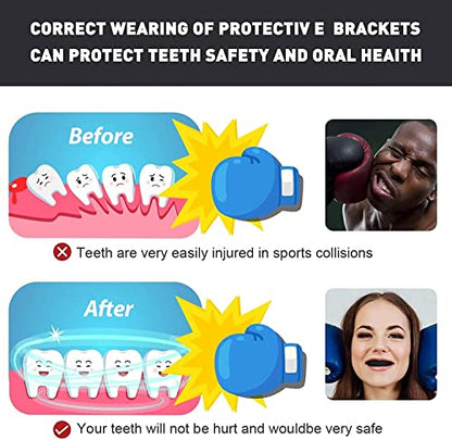 3 Pack Kids Youth Mouth Guard Football Sports Braces Mouthguards for Mouthpiece Boys Teeth for MMA Boxing Rugby Kickboxing Taekwondo Softball Lacrosse to Braces EVA (Black,White) - color: Black,white