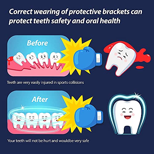 Youth Mouth Guard Football Sport Mouthguard, Premium Quality No Boiling Required，Suitable for Basketball, Wrestling, Taekwondo, Jujitsu and Karate - color: Colorless