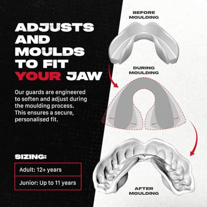SAFEJAWZ Mouth Guard, Triple Layer Mouthguard for Adults with Case, Easy Fit Remoldable Premium Mouthpiece for Football, Boxing, Lacrosse, MMA, Basketball & All Contact Sports (Adult 12+ Years, White) - color: White