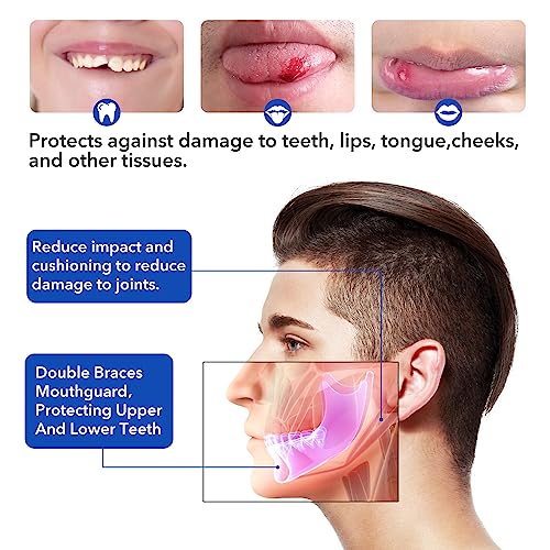 Mouth Guard Sports Youth Adult,Mouth Guard for Braces Soft,No Boiling - color: Blue/Strapless