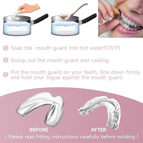 Mouth Guard for Women 4 Pack Medium Size - Pink