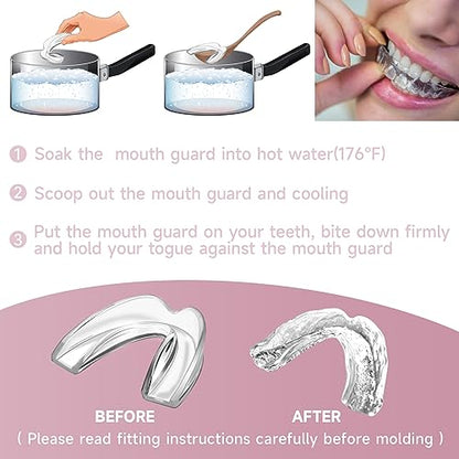 Mouth Guard for Women 4 Pack Medium Size - Pink