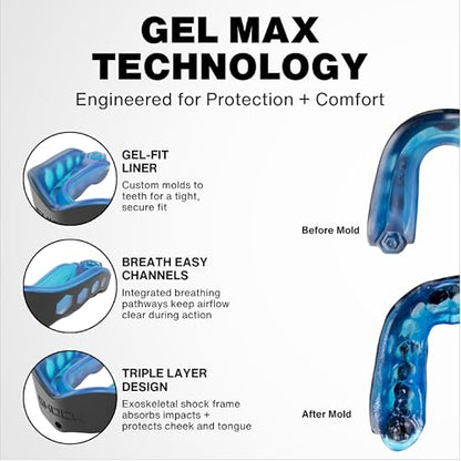 Shock Doctor Gel Max Power Carbon Convertible Mouth Guard - color: Red, size: Youth