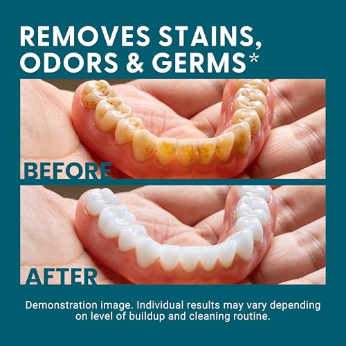 Denture Bath Case and Retainer Case, Denture Bath Cup for Invisalign Retainers Mouthguards Dentures Cleaner Kit with Strainer Spill-Free Portable Retainer Cleaner Case by M3 - size: 1 Count (Pack of 1)