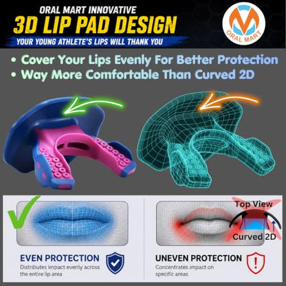 Oral Mart Flag Football Mouth Guard with 3D LipFit Design for Kids - Youth Football Mouthguard (No Boil) Cool Instant Fit Lip Guard Mouthpiece for Braces (Detachable Helmet Strap Included) - color: King Kong