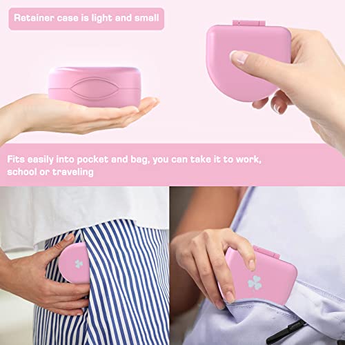 Retainer Case Denture Case: BVN Orthodontic Dental Case, Slim Braces Case, Mouth Guard Case, Denture Box, Teeth Aligner Case, Night Guard Case Container Storage Holder Pink - color: Pink