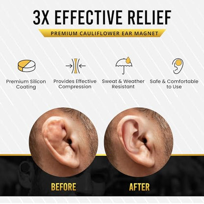 MagnetRX® Cauliflower Ear Magnets – 8 Multi–Size Magnets & Spacer with Case – Compression Ear Magnet for Cauliflower Draining, Pressure Earring for Keloids, BJJ, Wrestling & MMA Treatment & Prevention